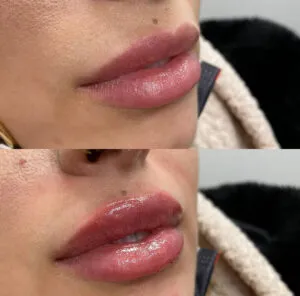 Lips