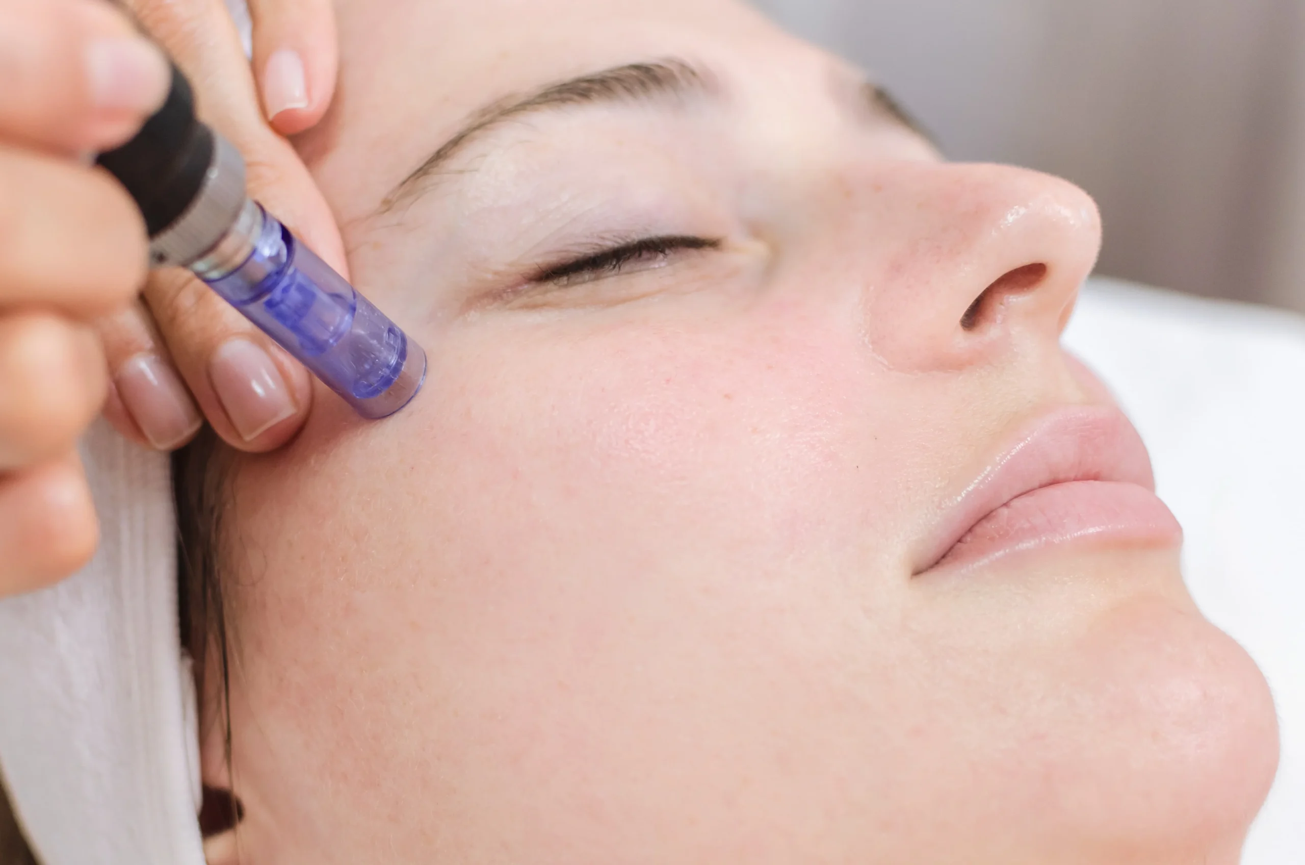 SkinPen® Microneedling with Rejuran Tone-UP Booster | Fayced Aesthetics | NYC