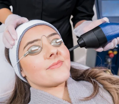 CO2 fractional ablative laser being used for skin rejuvenation (skin resurfacing) as a medical cosmetic procedure in a beauty laser clinic. Female patient wearing goggles, with beauty laser technician