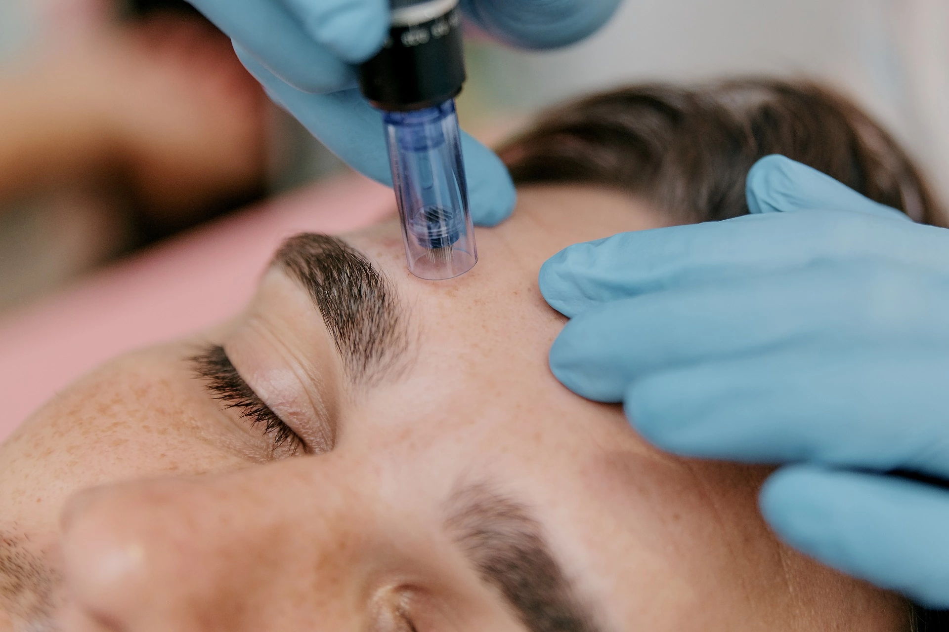SkinPen Microneedling with Botox | Fayced Aesthetics | New York