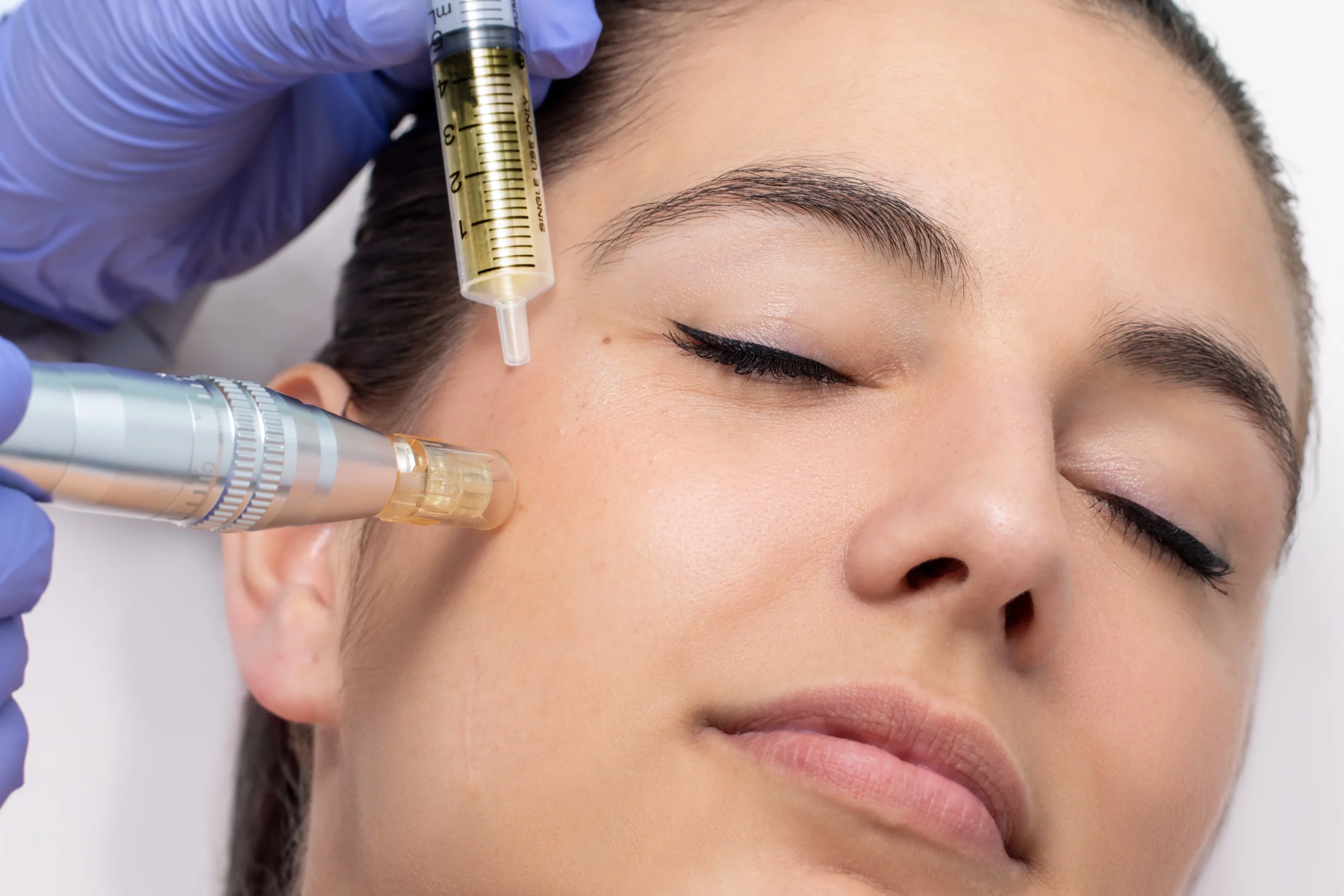 Woman getting SkinPen® Microneedling with Exosomes | Fayced Aesthetics NYC | New York, NY